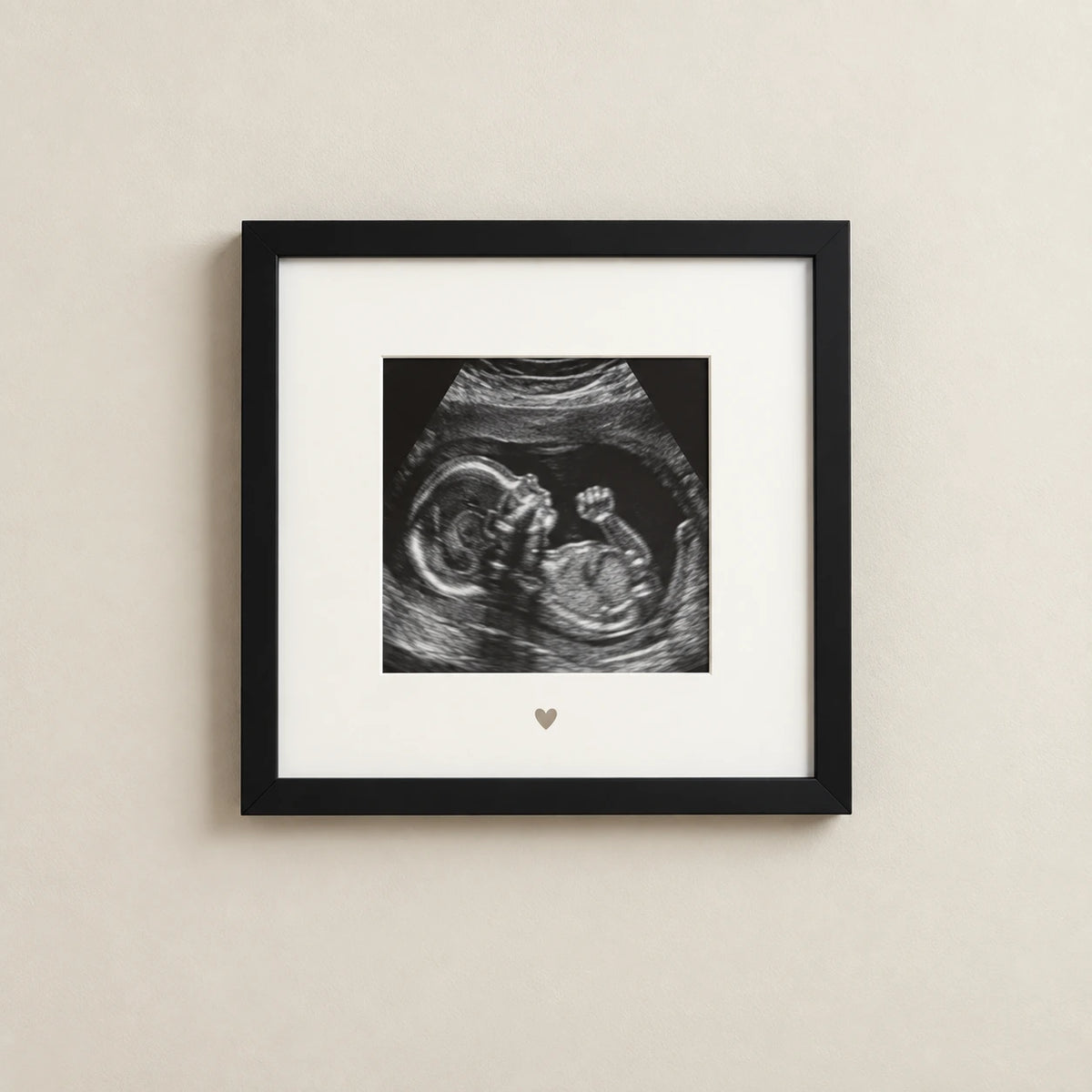 A prenatal ultrasound image displayed in a square black frame with a white mount