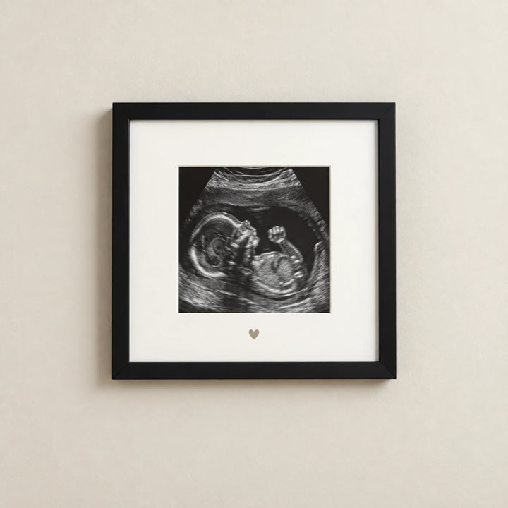 A prenatal ultrasound image displayed in a square black frame with a white mount